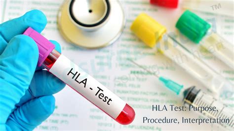 HLA Testing .